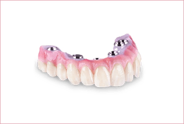 Discover the services of Dental Lab New York, Dentures, Crowns