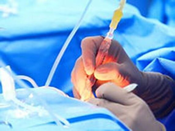 What are the significant benefits of Cataract Surgery?