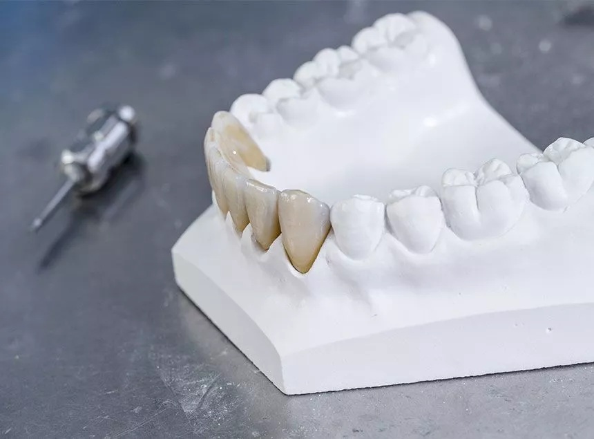 Why Dental Lab New York is very much important