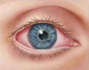 How the best Lasik Eye Surgery Specialist 33009 can help you